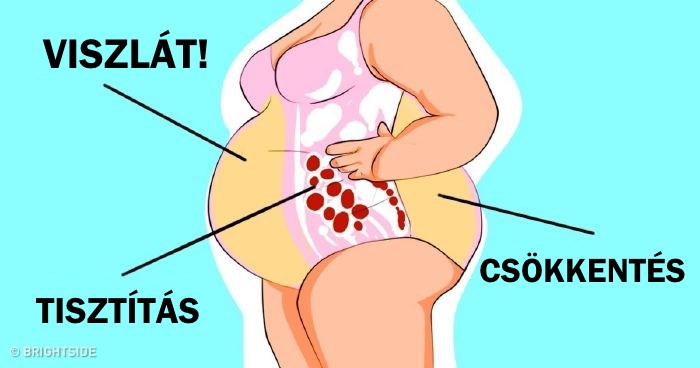 metabolikus súlycsökkenés, amelybe beleesik súlycsökkenés az endometriosis laparoszkópiája után