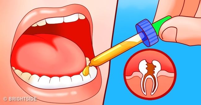 okozhat e fogyást a fogfájás)