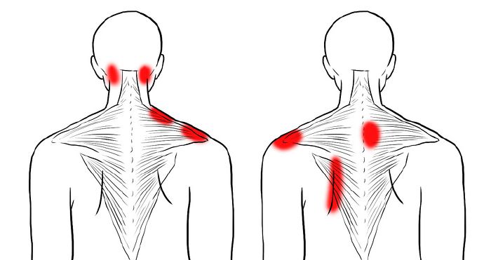 oldalsó nyaki fájdalom néha a csípőízület fáj