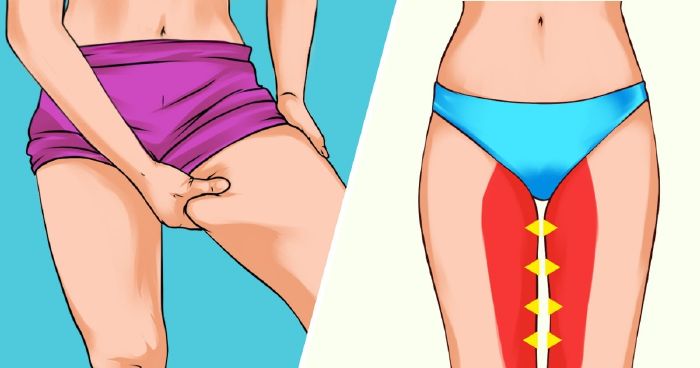 Hogyan lehet elveszíteni a comb belső kövér nőstényét. Leopárdgekkó – Wikipédia