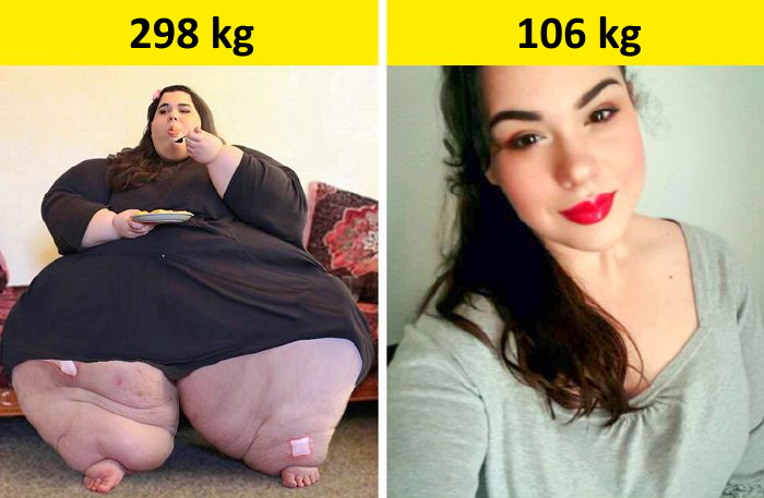 Nem vidámabbak a túlsúlyos emberek