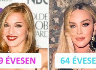 Villával feszesíti a bőrét, és egyéb titkok Madonna fiatalos ragyogása mögött