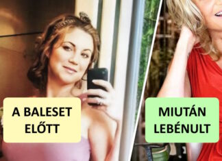 Egy szörnyű balesetben lebénult nő minden tabut ledöntött és divatinspirációvá vált