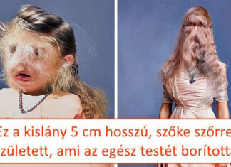 15 lélegzetelállító fotó, ami bizonyítja, hogy az emberi test a csodák csodája