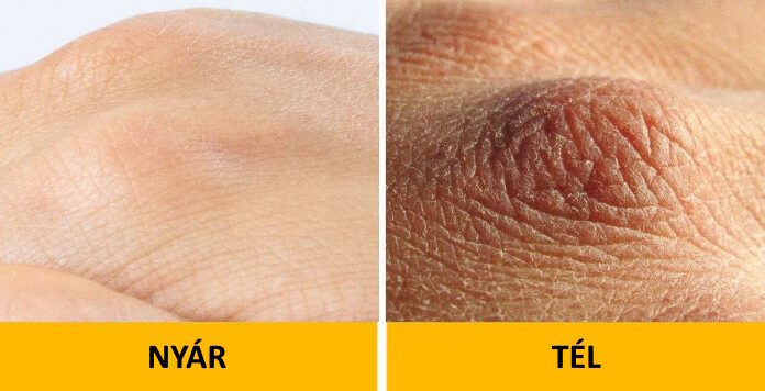 7 dolog, ami télen történhet a testeddel